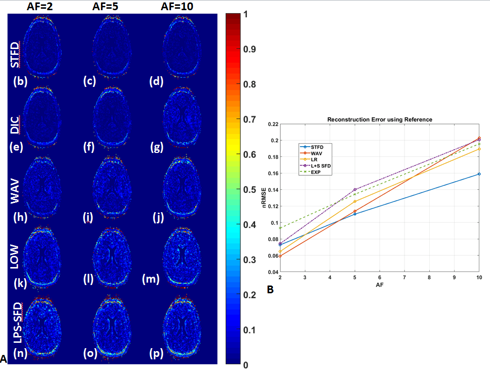 Comparison of Compressed Sensing Algorithms for accelerating ...